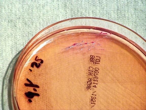 CDC microscopy image of Yersinia pestis, the bacterium that causes plague, central to the Irkutsk laboratory death investigation